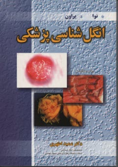 پایانه - انگل شناسی پزشکی